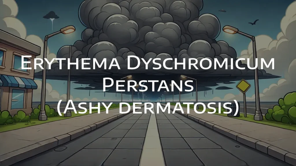 Erythema Dyschromicum Perstans 
(Ashy dermatosis) DermatoGraphix Dermnemonics
